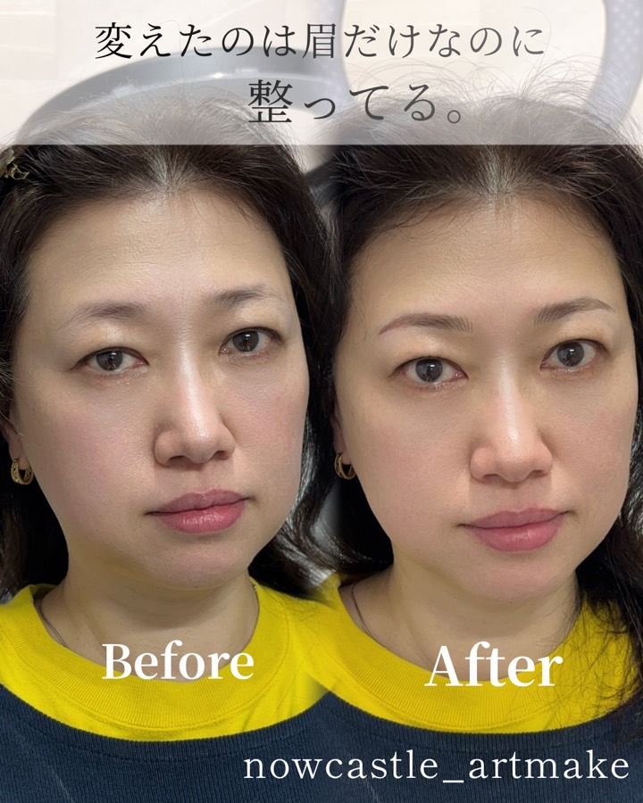 薄くなった自眉を自然に整えた女性の眉症例