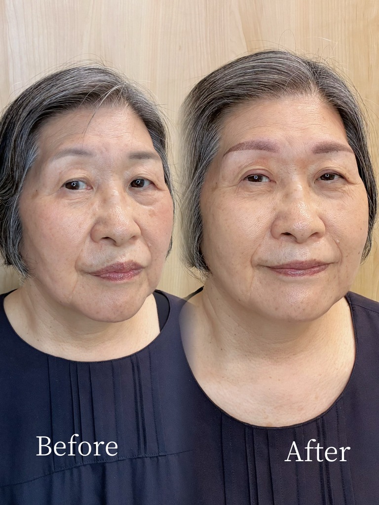 70代女性の韓国式パウダー眉の施術前後症例