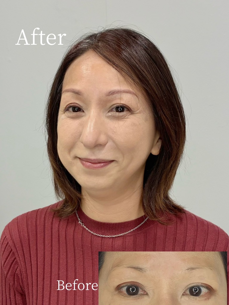 50代女性の韓国式パウダー眉症例