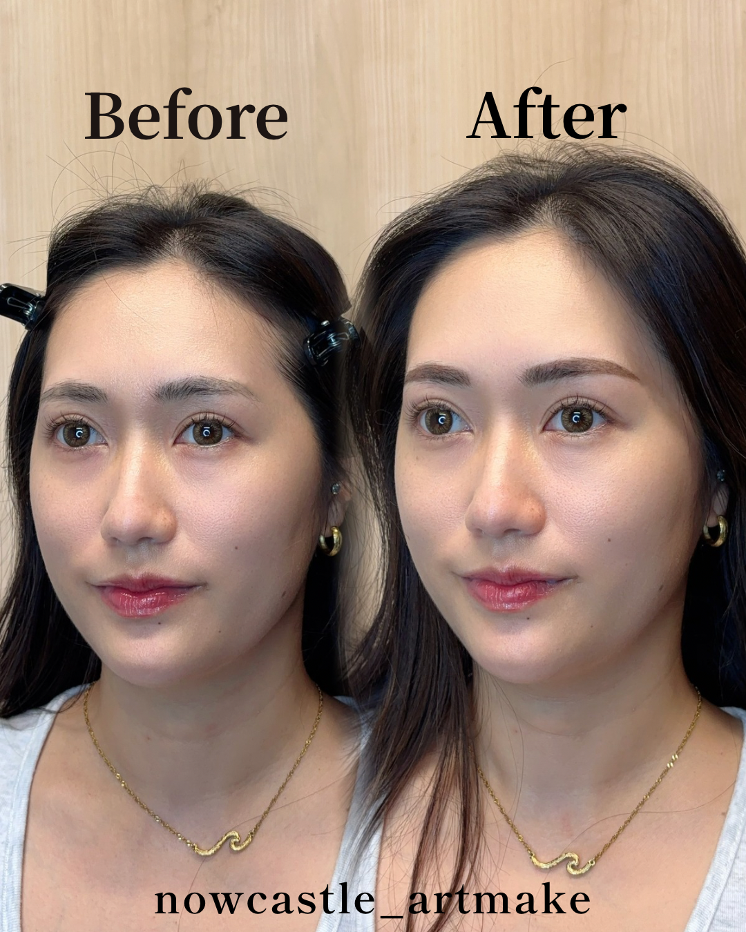 他院アートメイクの色味と形を整えた30代女性の症例