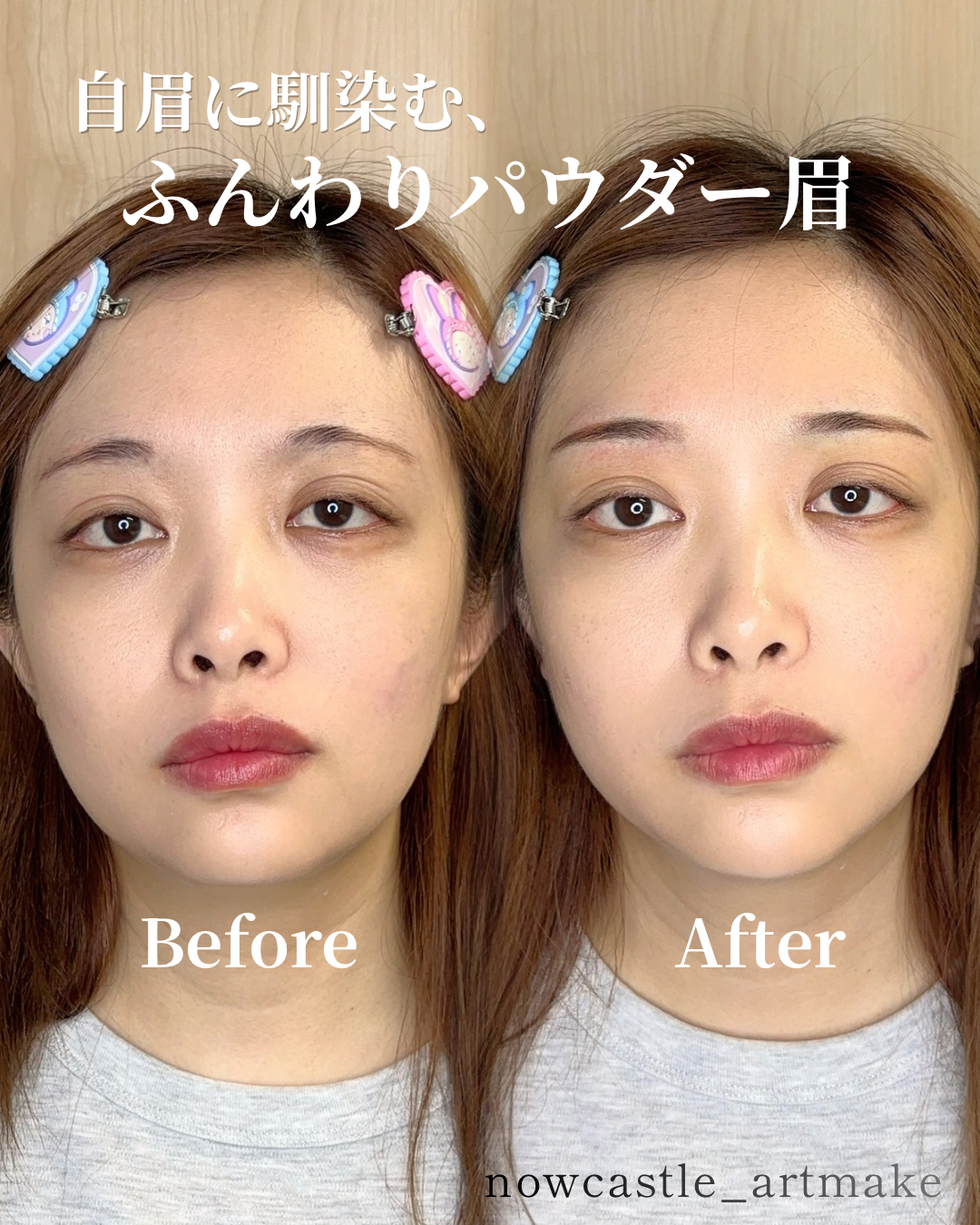 他院施術後の色味を補正した30代女性のパウダー眉症例