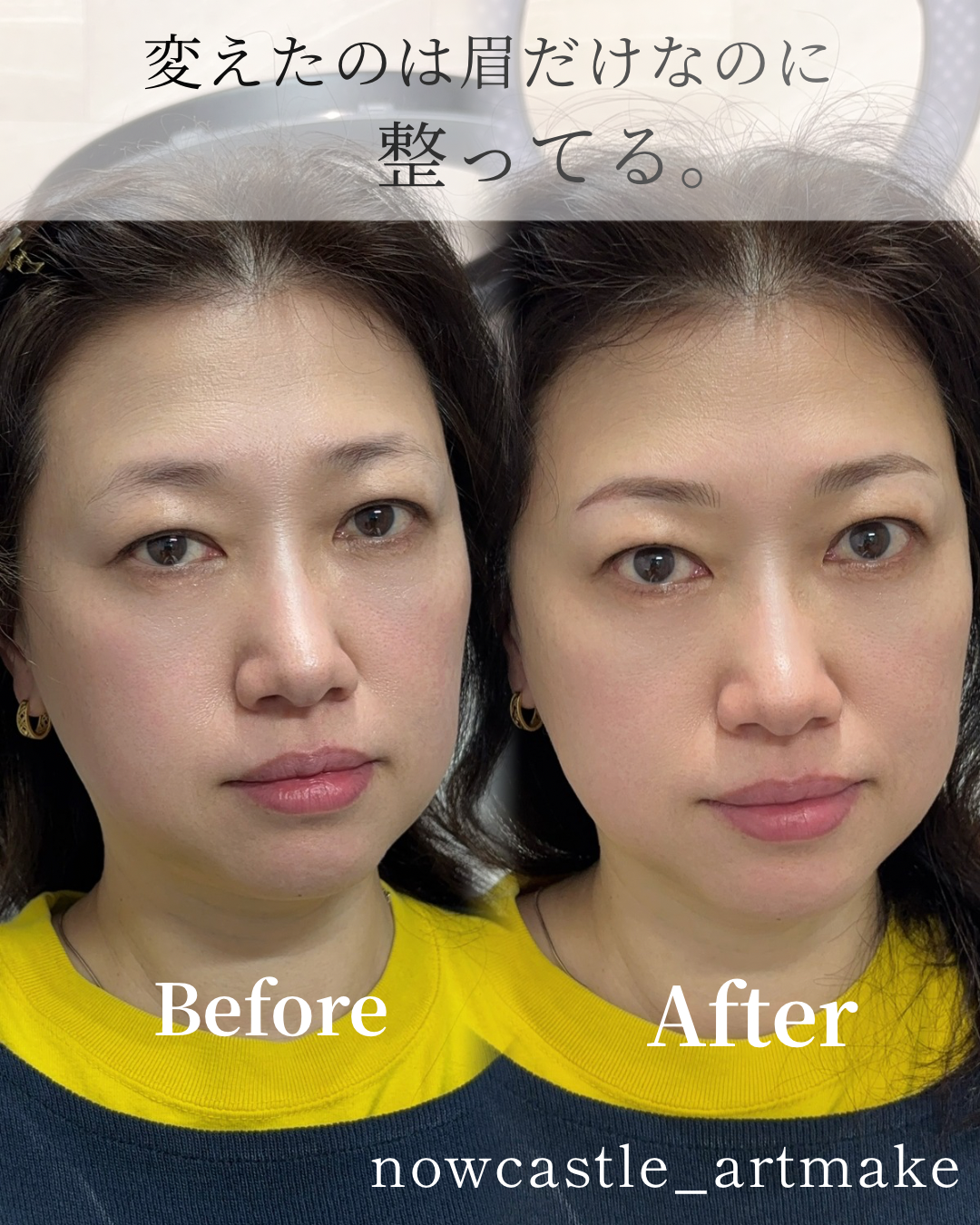 薄くなった自眉を自然に整えた60代女性の眉症例