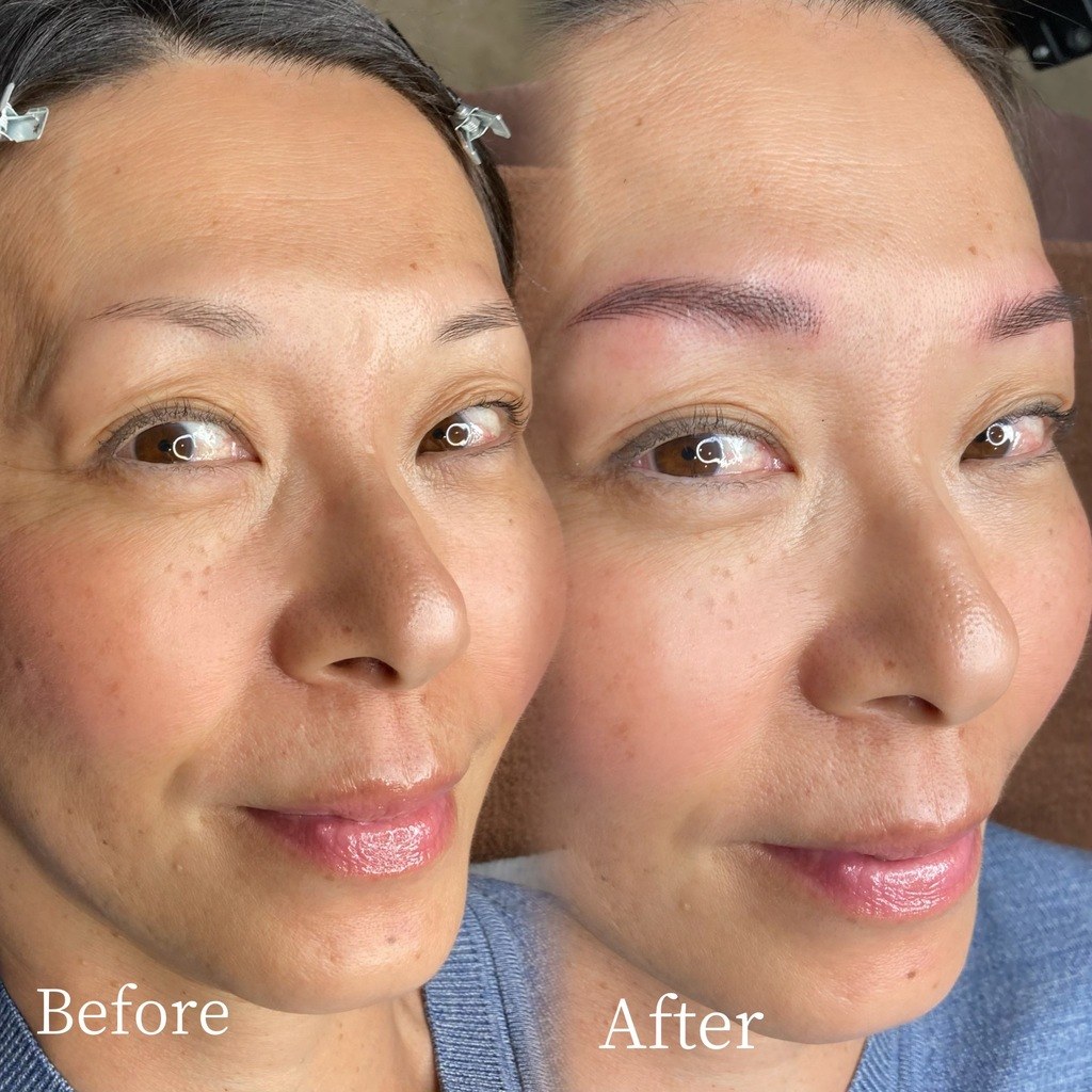 40代女性の短い眉を補ったナノヘアストローク症例
