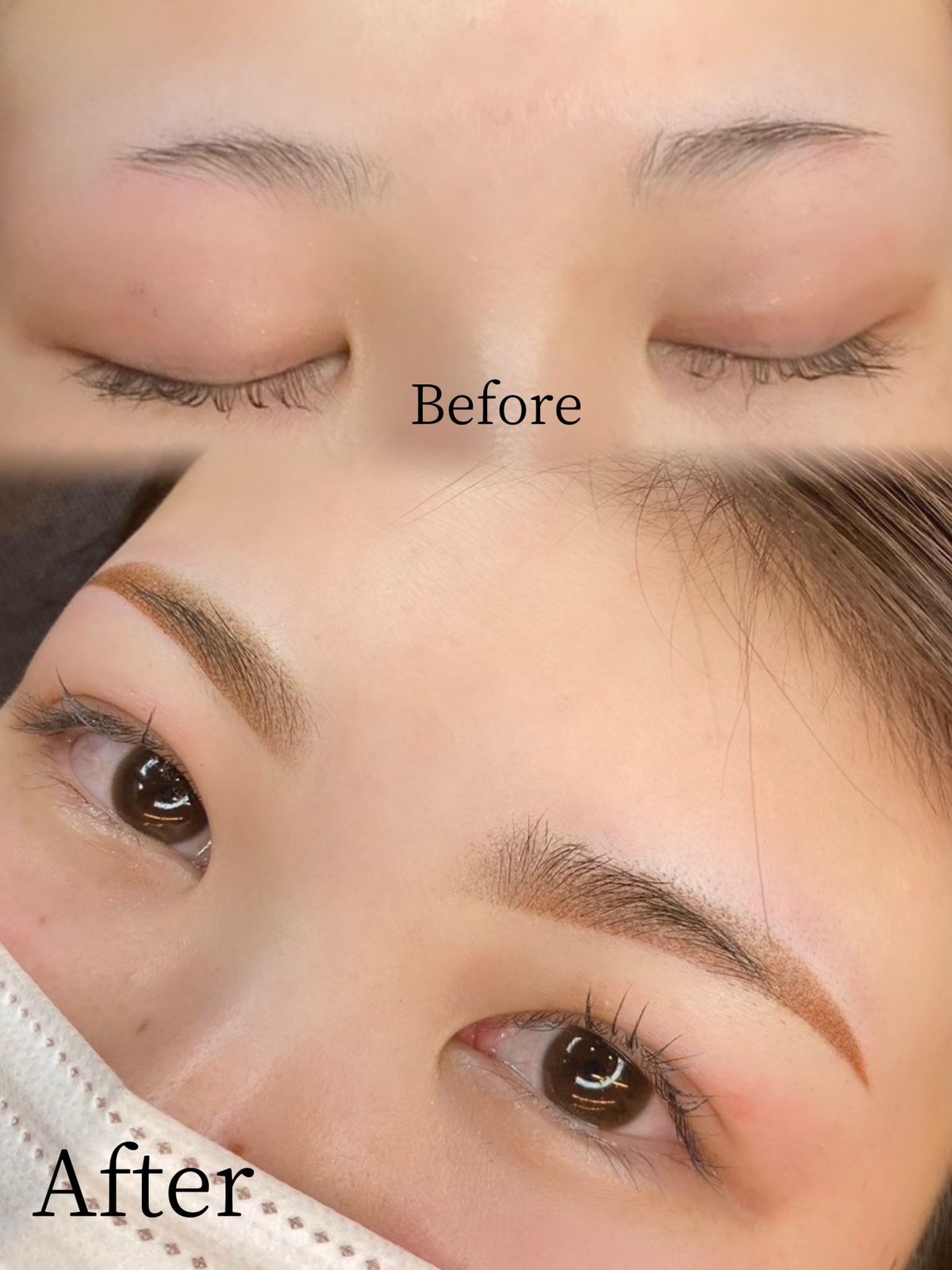 20代女性の韓国式パウダー眉症例